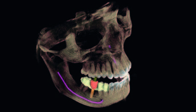 x-ray-01