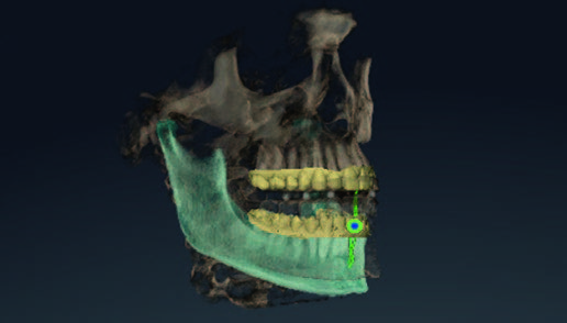 x-ray-03